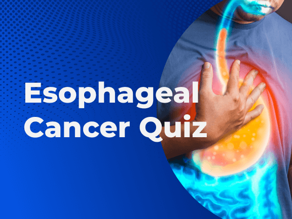 Esophageal Cancer Quiz