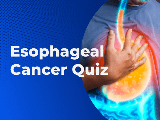 Esophageal Cancer Quiz